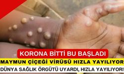 Dünya sağlık örgütünden maymun çiçeği uyarısı! eskisinden hızlı yayılıyor