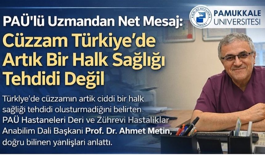 Prof. Dr. Ahmet Metin: “Cüzzam Korkulacak Bir Hastalık Olmaktan Çıktı”