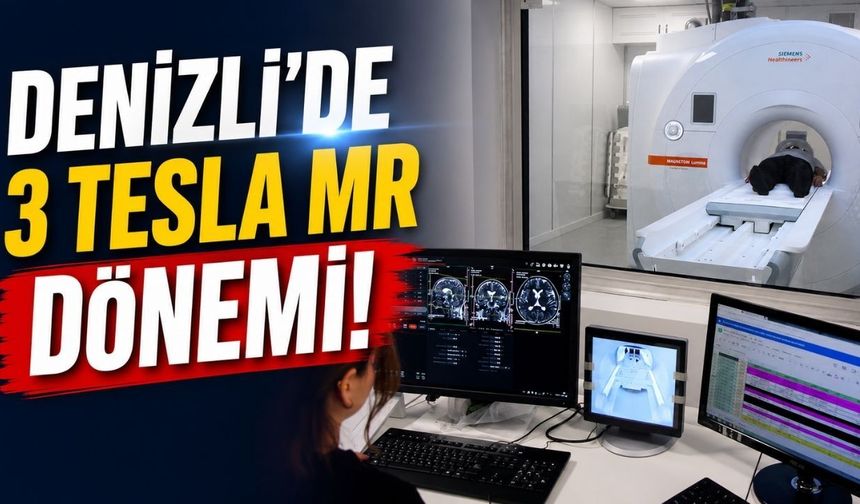 Denizli’de İlk ve Tek! Yapay Zekâ Destekli 3 Tesla MR Hizmete Girdi