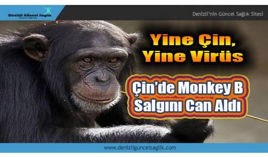 Koronadan Sonra Yeni Kabus: Monkey B Virüsü