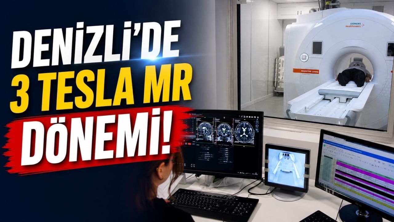 Denizli’de İlk ve Tek! Yapay Zekâ Destekli 3 Tesla MR Hizmete Girdi